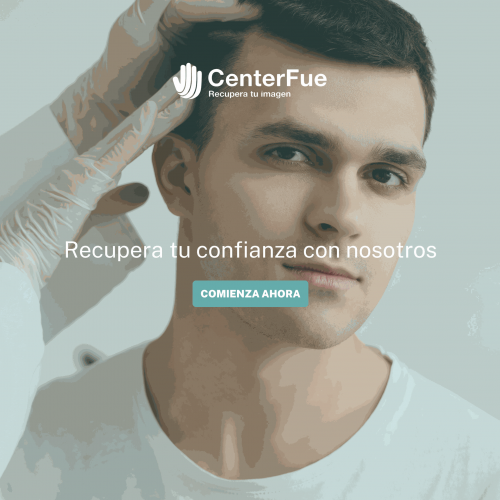 centerfue